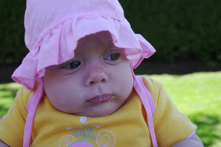 Sun Bonnet