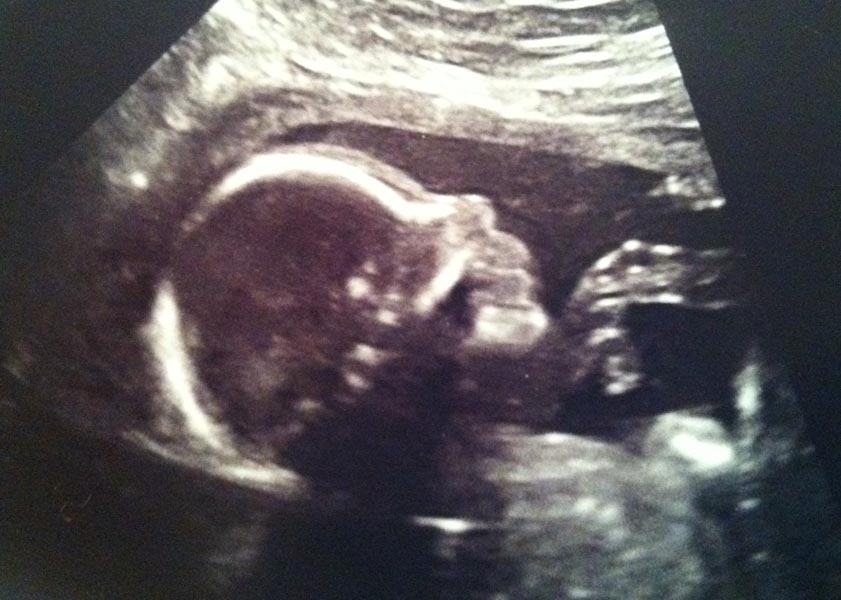 Little Elliot James